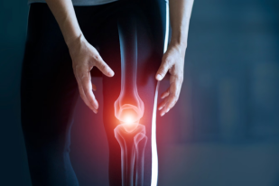 Bone Health: How to Keep Your Bones Strong and Healthy