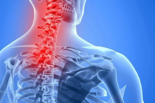Neck Pain: Causes, Prevention, and Treatment Options